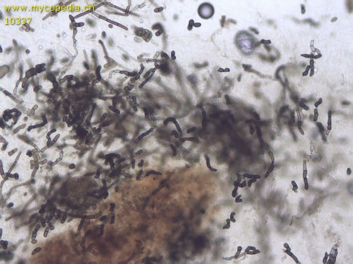 Helminthosphaeria clavariarum - Konidien - 