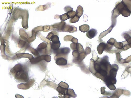 Helminthosphaeria clavariarum - Konidien - 