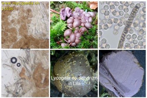 Lycogala epidendrum - 