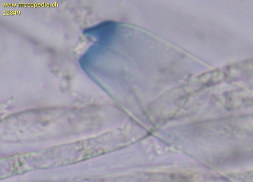 Peziza echinospora - Ascusspitze mit geffnetem Operculum - Melzers  - 