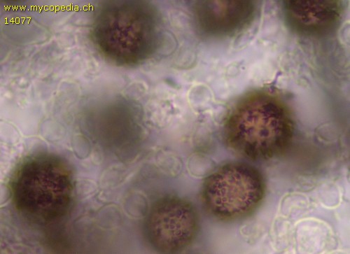 Scleroderma areolatum - Spore/n - 