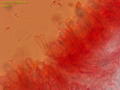 Entoloma poliopus - Cheilozystiden - 