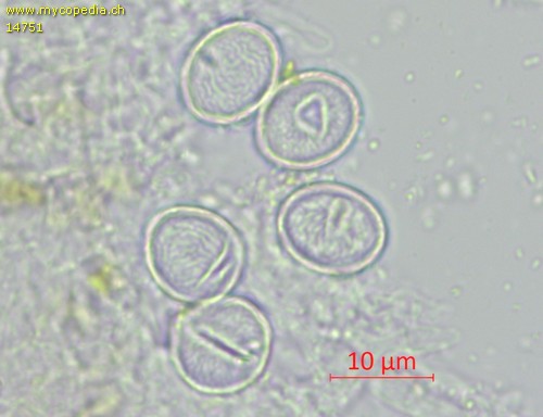 Lasiobolus microsporus - Sporen - Wasser  - 