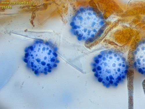 Scutellinia citrina - Sporen - Baumwollblau  - 