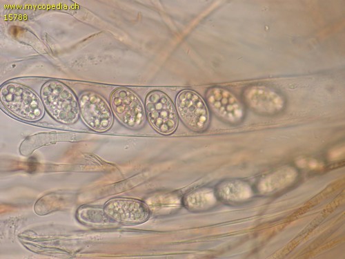 Scutellinia kerguelensis - Sporen unreif - 