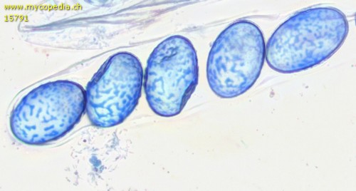 Scutellinia kerguelensis - Sporen - Baumwollblau  - 