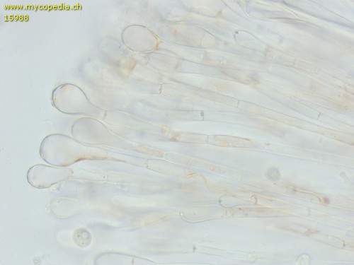 Scutellinia torrentis - Paraphysen - 
