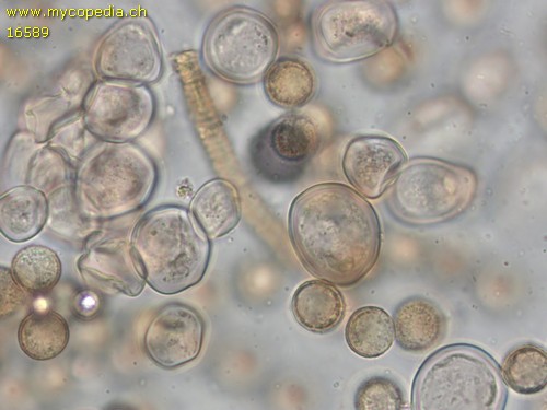 Arcyria ferruginea - Sporenhnliche Zysten - 