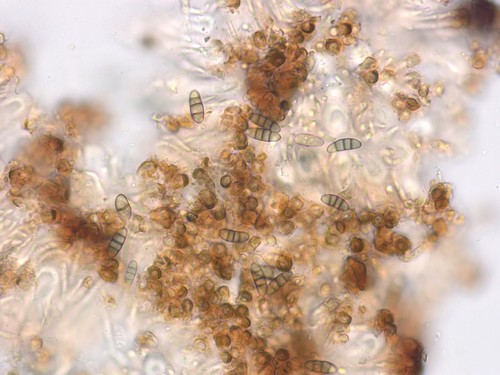 Dactylospora lignicol - 