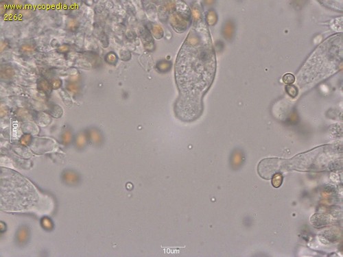 Psathyrella spadiceogrisea - Cheilozystiden - 