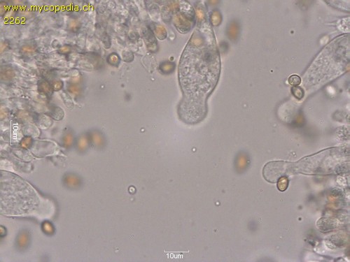 Candolleomyces candolleanus - Cheilozystiden - 