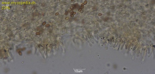Pholiota adiposa - Cheilozystiden - 