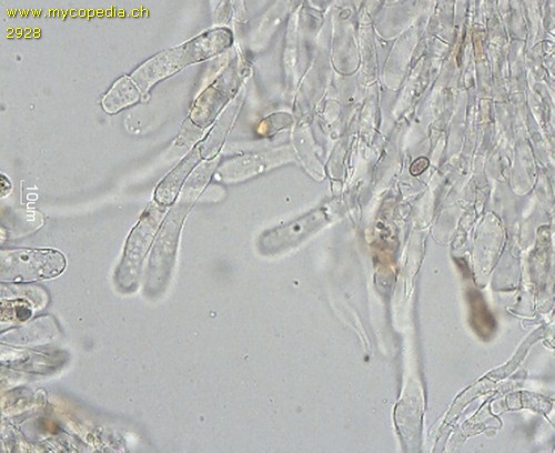 Pseudosperma rimosum - Kaulozystiden an Stielspitze - 