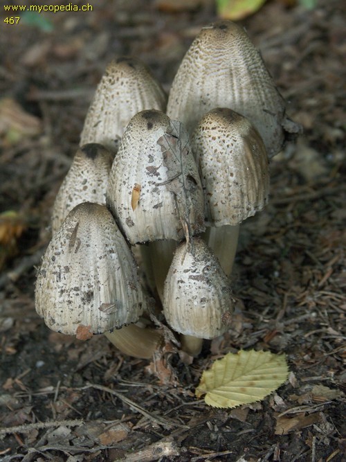 Acetaldehyd-Syndrom, Coprinus-Syndrom - 