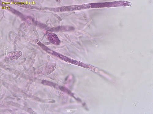Russula nauseosa - Pileozystiden - Karbolfuchsin  - 