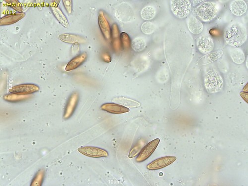 Leccinellum pseudoscabrum - Cheilozystiden - 