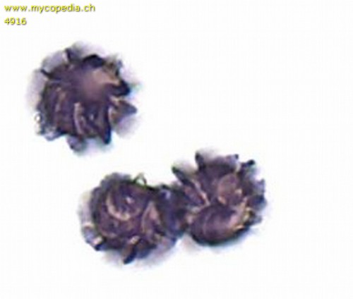 Amyloiditt - Spore/n - Melzers  - 