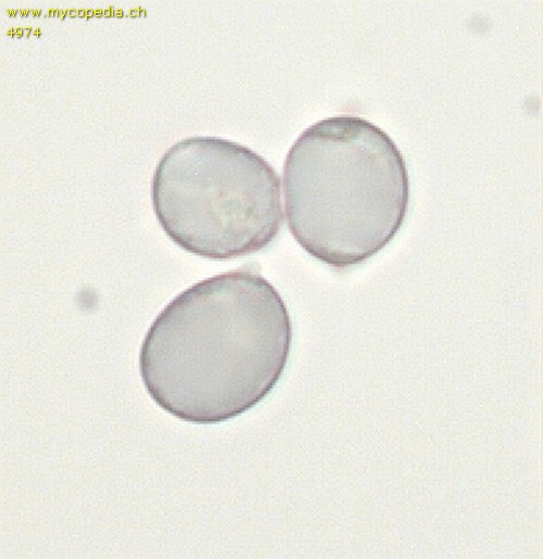 Amyloiditt - Spore/n - 