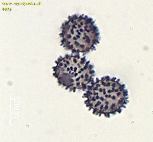 Amyloiditt - Spore/n - Melzers  - 