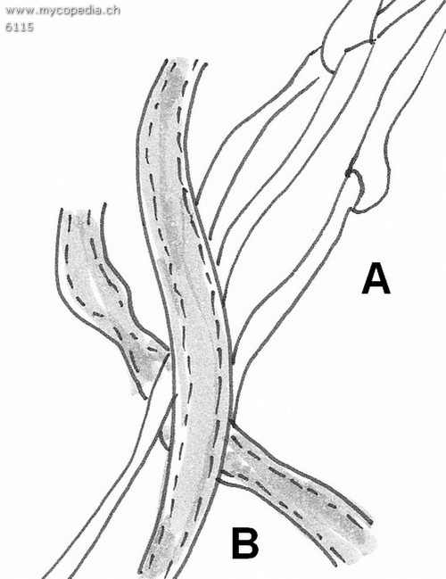 dimitisches Hyphensystem