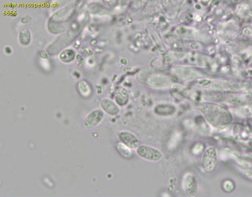 Mycoacia uda - Sporen - Wasser  - 