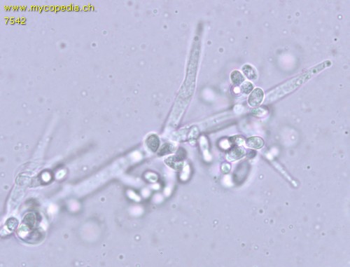 Aspergillose - 