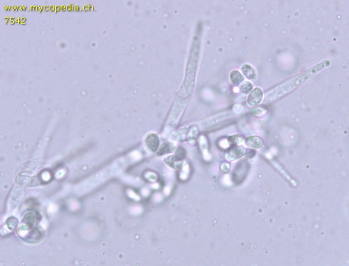 Aspergillose - 