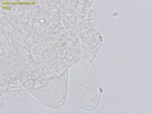 Coprinopsis cinereofloccosa - Cheilozystiden - 