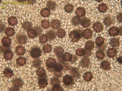 Scleroderma citrinum - Spore/n - 