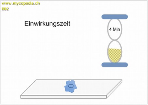 Metachromasie - 