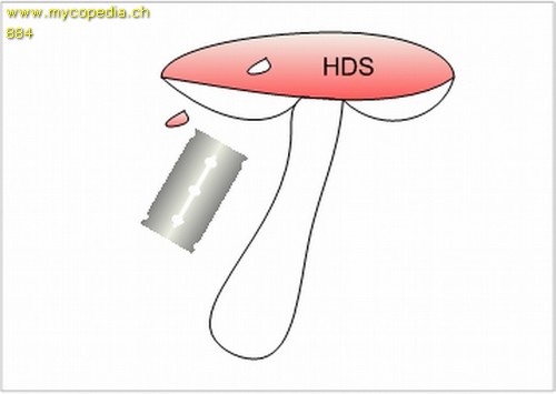 Metachromasie - 