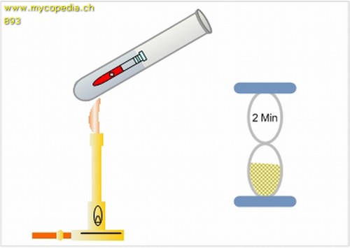 Siderophile Granulation - 